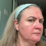 serum for maturing skin redness